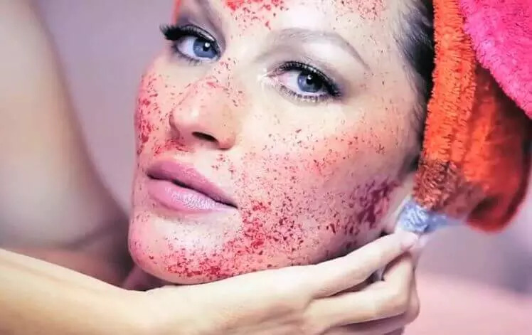 Vampire Facial Treatment
