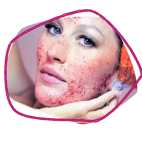 Vampire Facial
